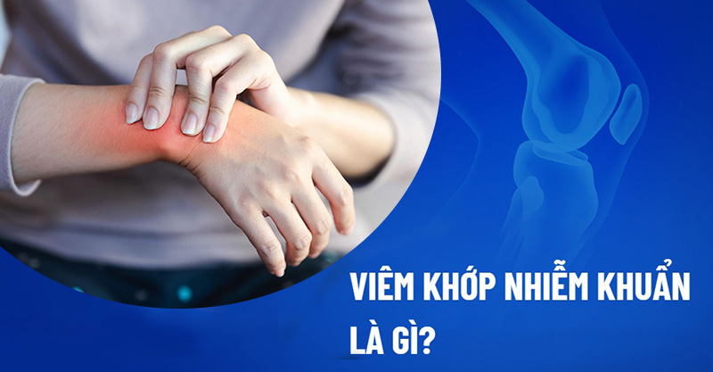 Viêm khớp nhiễm khuẩn