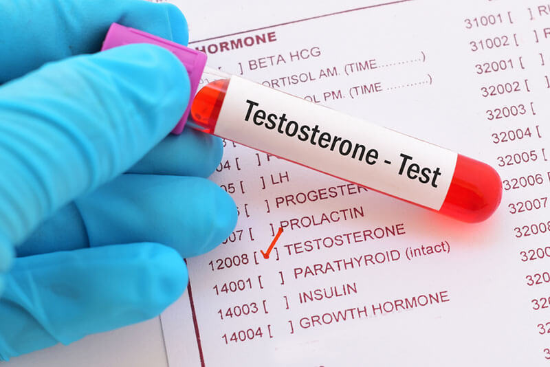 Kiểm tra nồng độ Testosterone để chẩn đoán mãn dục nam