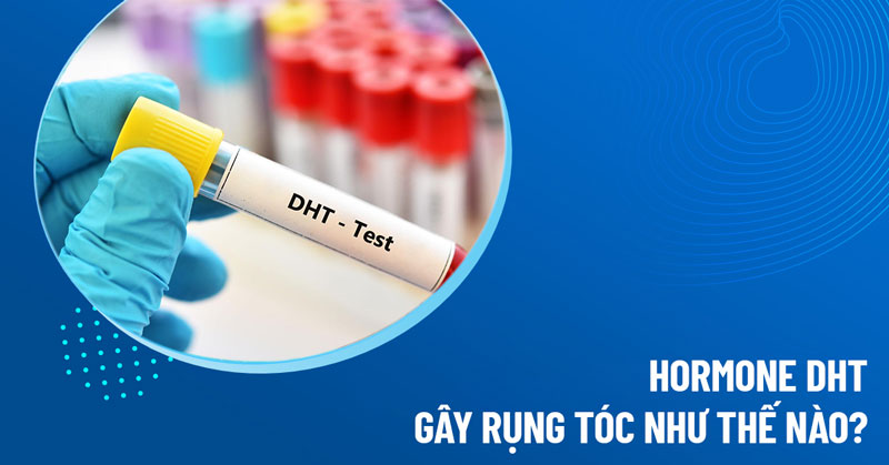 hormone dht gây rụng tóc thế nào