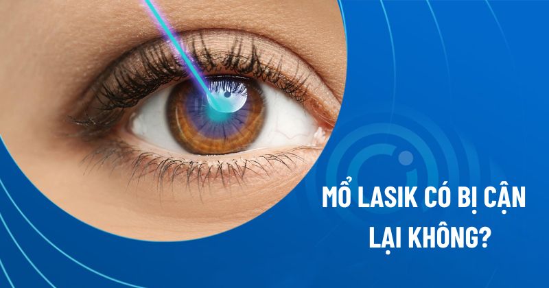 Mổ Lasik có bị cận lại không?