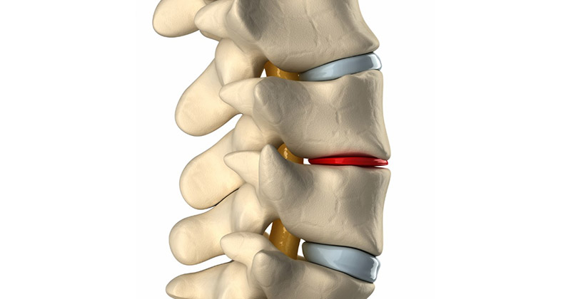 Nguyên nhân gây viêm khớp liên mấu