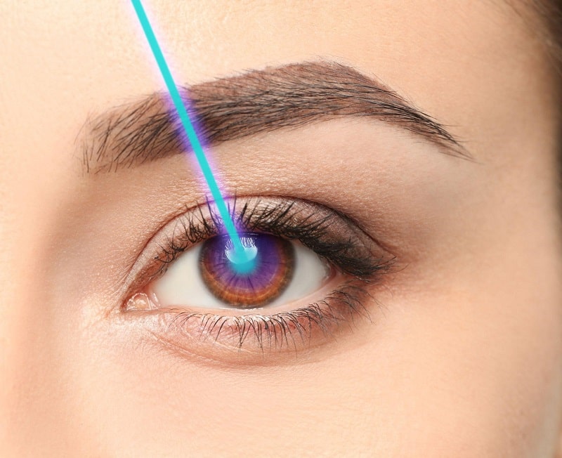 Phương pháp phẫu thuật Femto Lasik là gì?