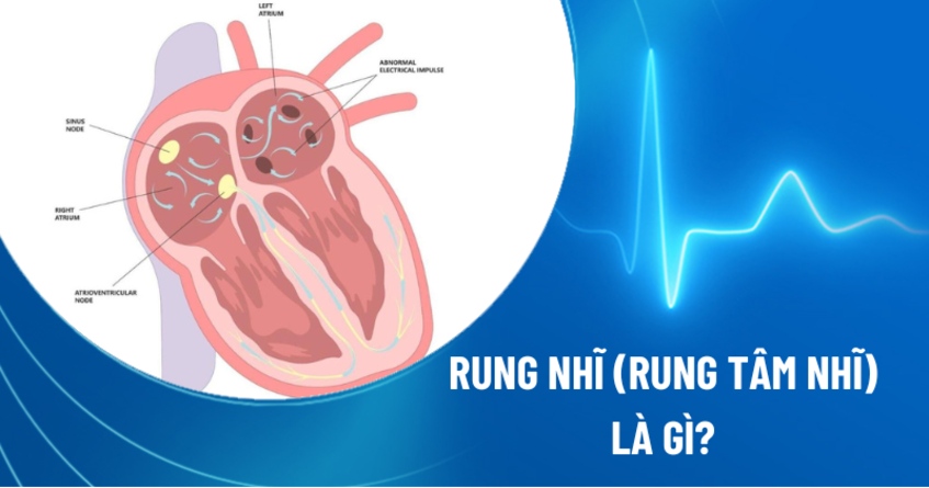 rung nhĩ