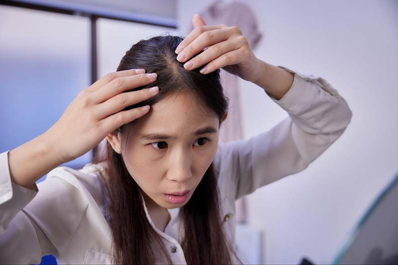 rụng tóc nhiều ở nữ