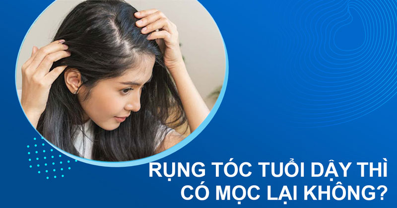 bị rụng tóc ở tuổi dậy thì có mọc lại không