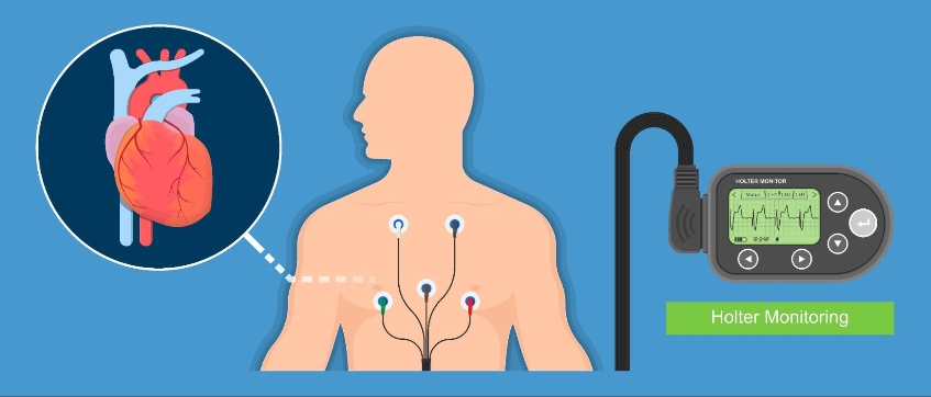 tim đập nhanh khi ngủ trưa