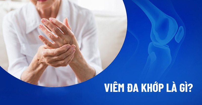 Viêm đa khớp