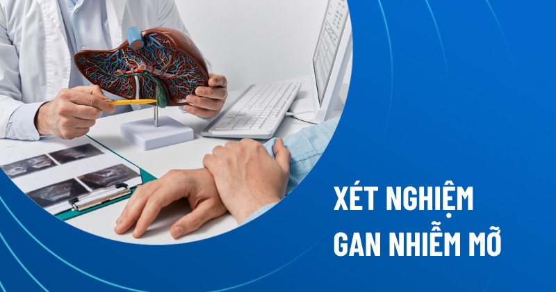 xét nghiệm gan nhiễm mỡ