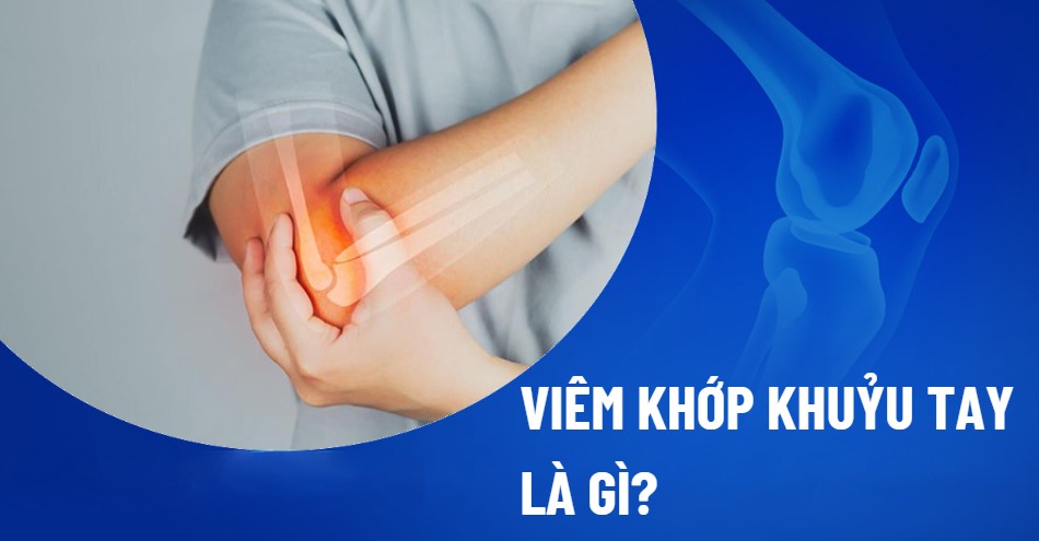 Bệnh viêm khớp khuỷu tay