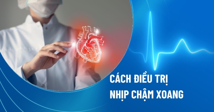 3 cách điều trị nhịp chậm xoang và biện pháp phòng ngừa hiệu quả