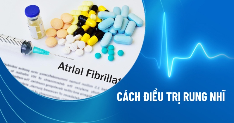 5 cách điều trị rung nhĩ (rung tâm nhĩ) và phòng ngừa bệnh phổ biến