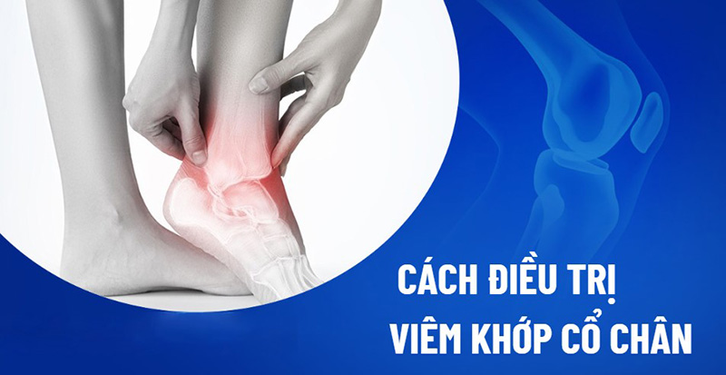 Điều trị viêm khớp cổ chân