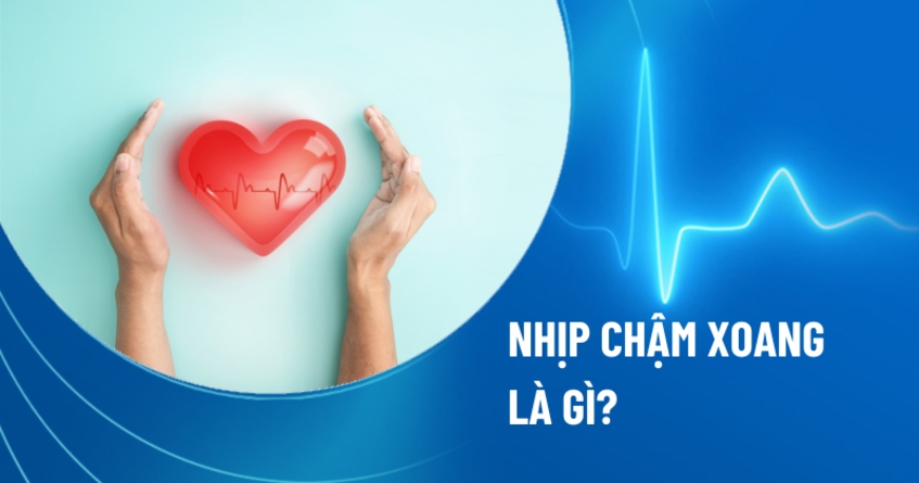 Nhịp chậm xoang là gì? Nguyên nhân, triệu chứng và chẩn đoán bệnh