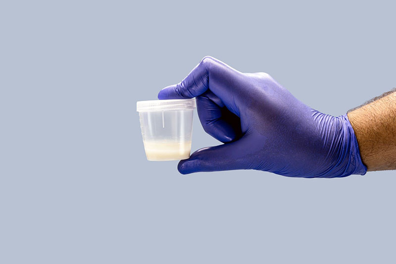 Nồng độ hormone testosterone ảnh hưởng tới chất lượng tinh trùng