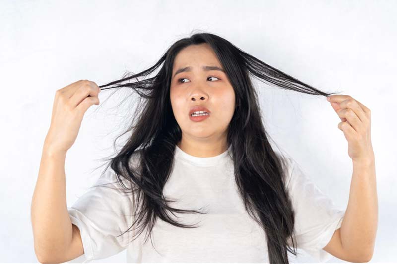 rụng tóc gây thiếu tự tin ở nữ giới