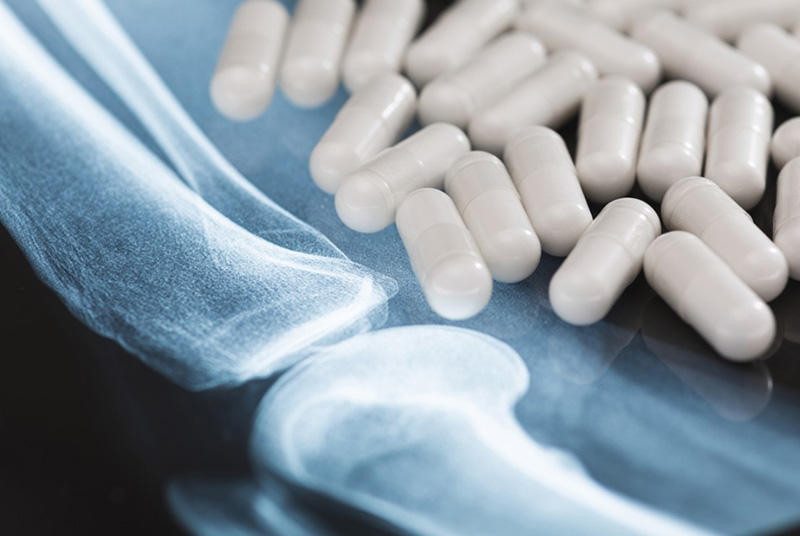 Thuốc bổ xương khớp là gì