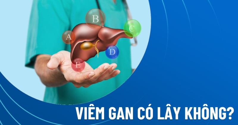 viêm gan có lây không