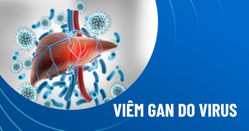 viêm gan do virus