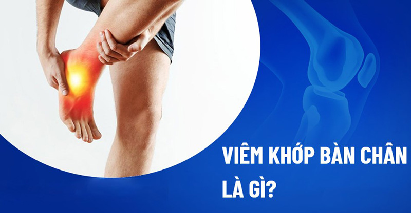 Viêm khớp bàn chân