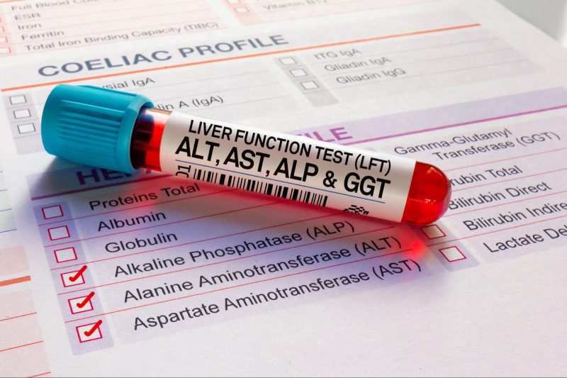 xét nghiệm viêm gan do virus