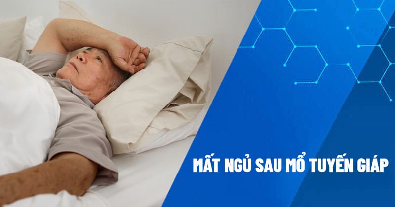 Mất ngủ sau khi mổ tuyến giáp