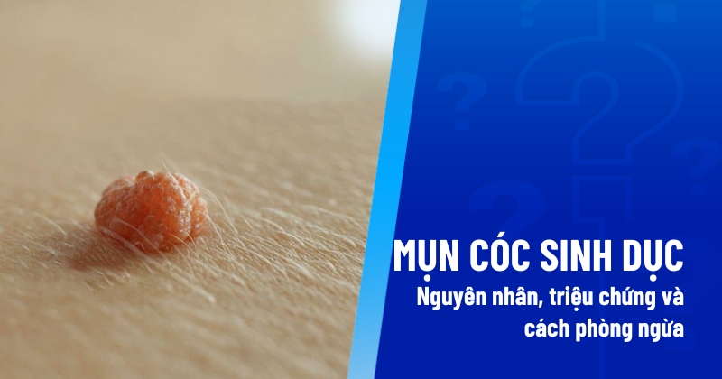Mụn cóc sinh dục
