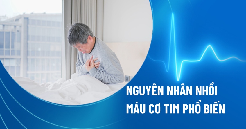 nguyên nhân nhồi máu cơ tim