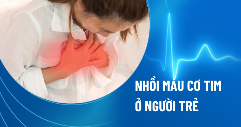 Nhồi máu cơ tim ở người trẻ
