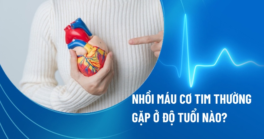 Nhồi máu cơ tim thường gặp ở độ tuổi nào? Độ tuổi nguy cơ cần lưu ý