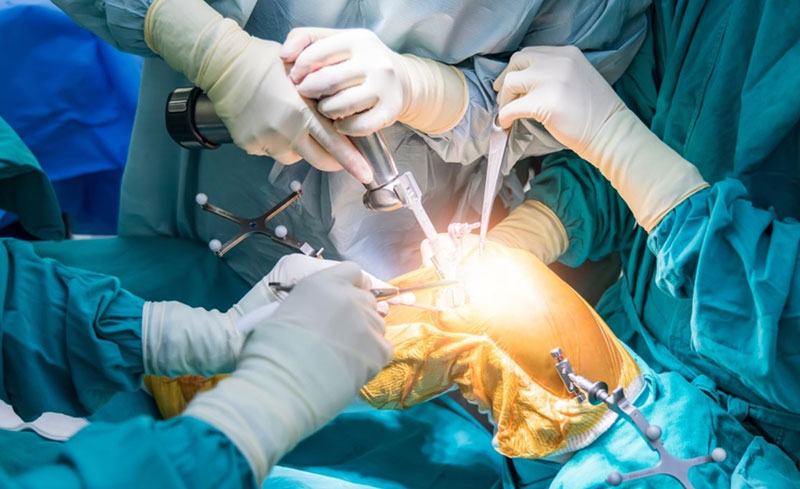 Phẫu thuật viêm khớp vảy nến