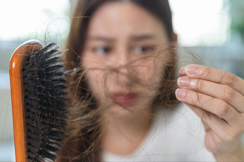 rụng tóc nhiều khi chải tóc