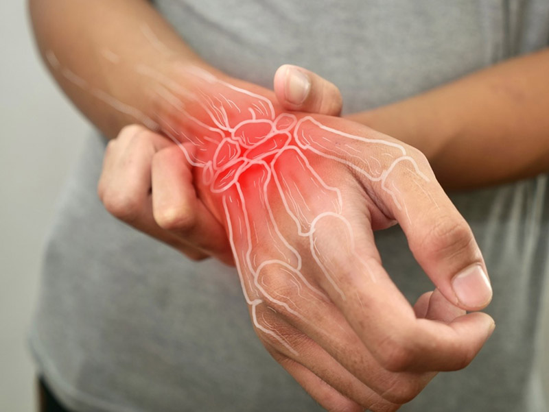 Tập luyện có thể hỗ trợ cải thiện viêm khớp dạng thấp