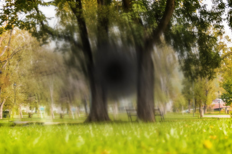 Thoái hóa điểm vàng