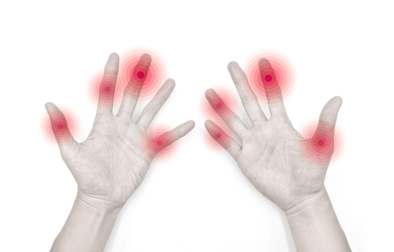 Viêm đa khớp ảnh hưởng trên nhiều khớp