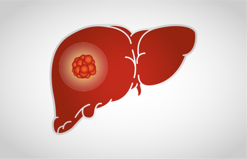 viêm gan c có nguy hiểm