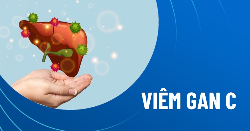 viêm gan c