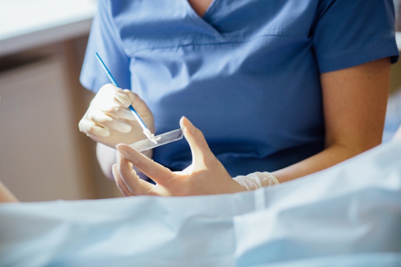 Xét nghiệm HPV