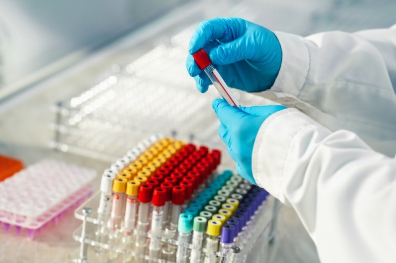 Xét nghiệm máu để chẩn đoán bệnh lây qua đường tình dục