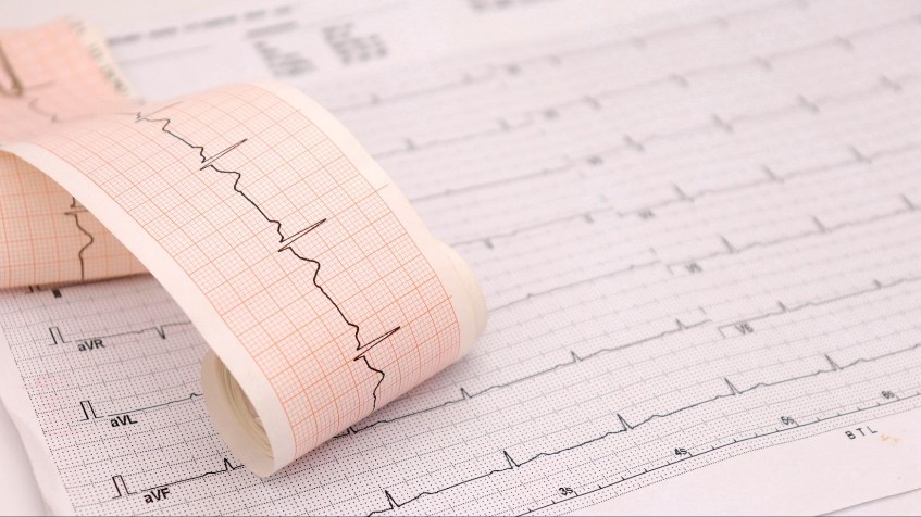 cách điều trị suy tim