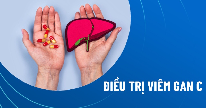 điều trị viêm gan c
