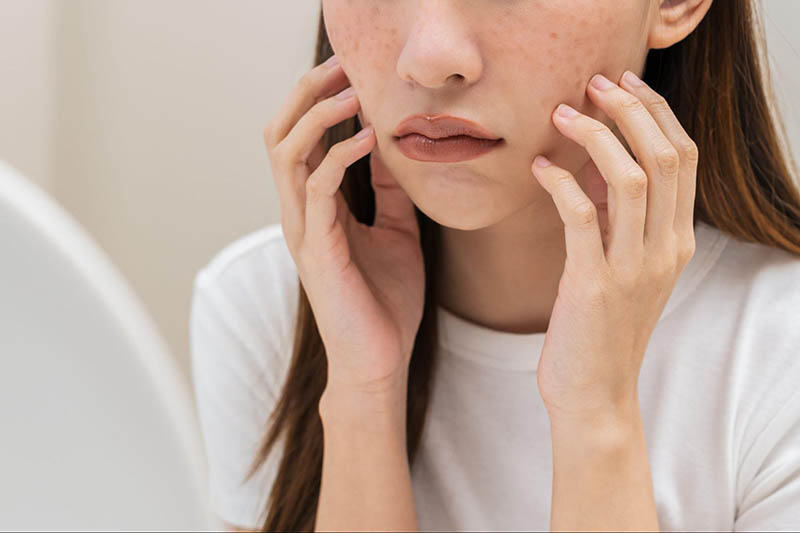 Nám chân sâu có trị được không Nám chân sâu có trị được không