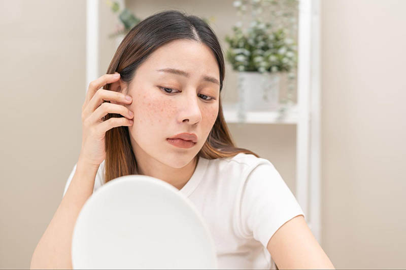 Nhận biết nám mảng