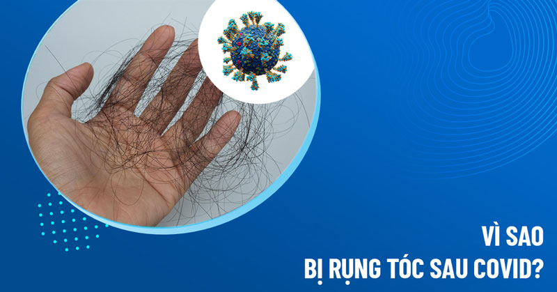 rụng tóc sau covid