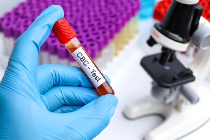 Phân tích tế bào máu