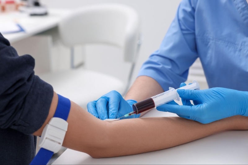 quy trình xét nghiệm viêm gan a