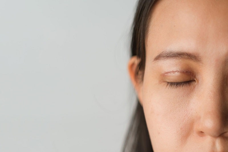 Tầm nhìn được mở rộng