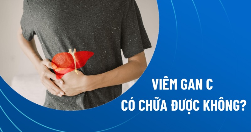 viêm gan c có chữa được không