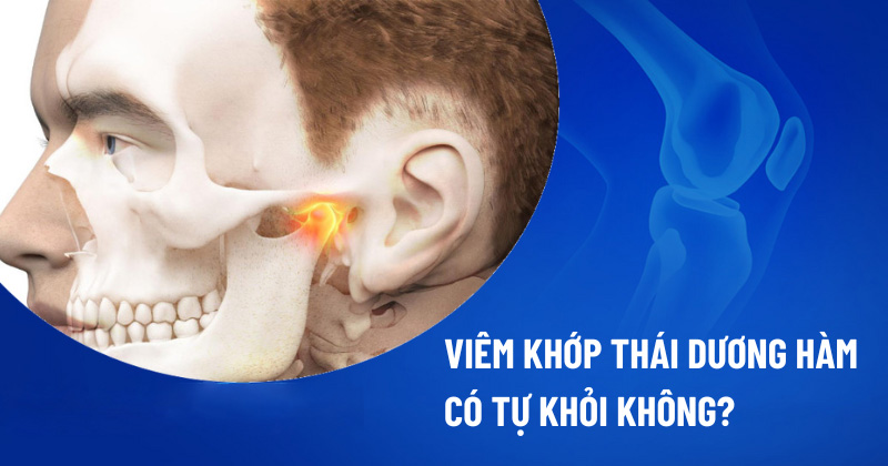 Viêm khớp thái dương hàm có tự khỏi không