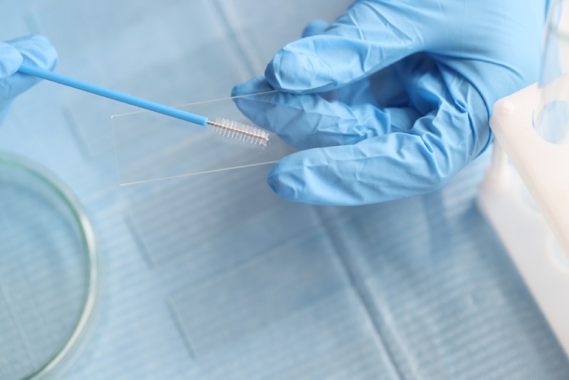 Xét nghiệm chẩn đoán HPV