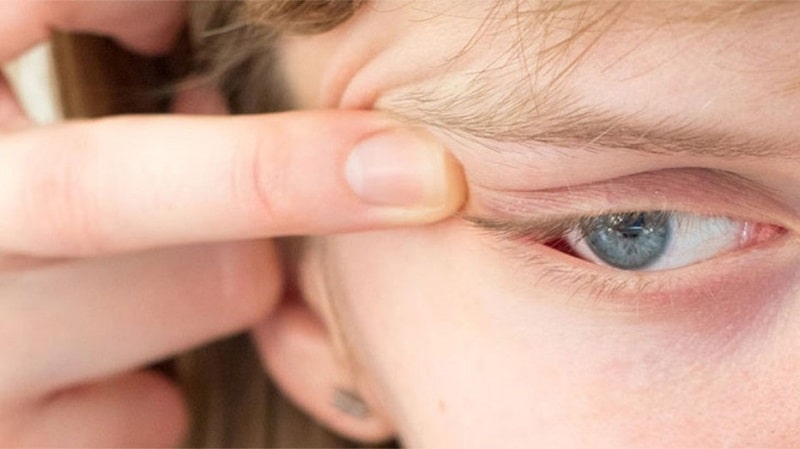Cách lấy lens ra khỏi mắt bằng tay